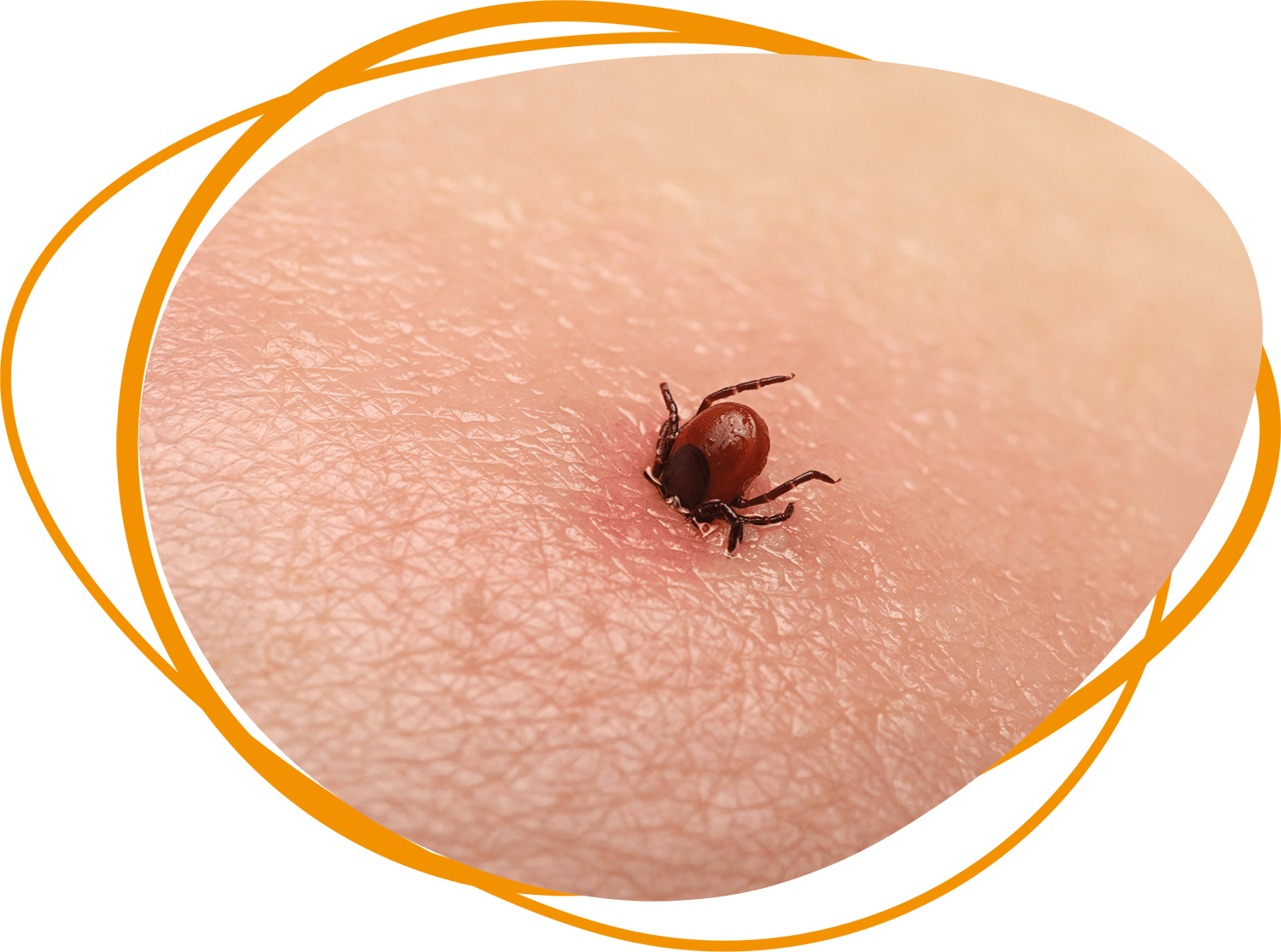 Header Blog - Hoe verwijder je een teek