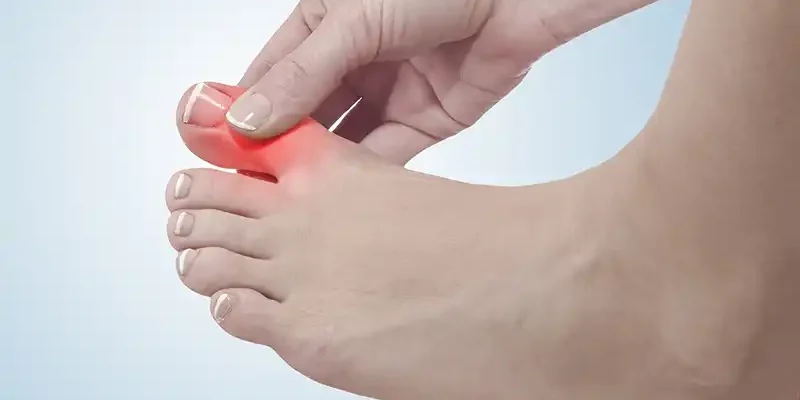 Blog-Gekneusde-teen-Savitae